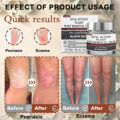 Divifit® Black Rice Skin Repair Essence Cream ⚕️ FDA Certified (Eliminates warts and skin tags, relieves psoriasis, improves keratin build-up and follicular keratinization, fades pigmentation, sun spots & age spots)