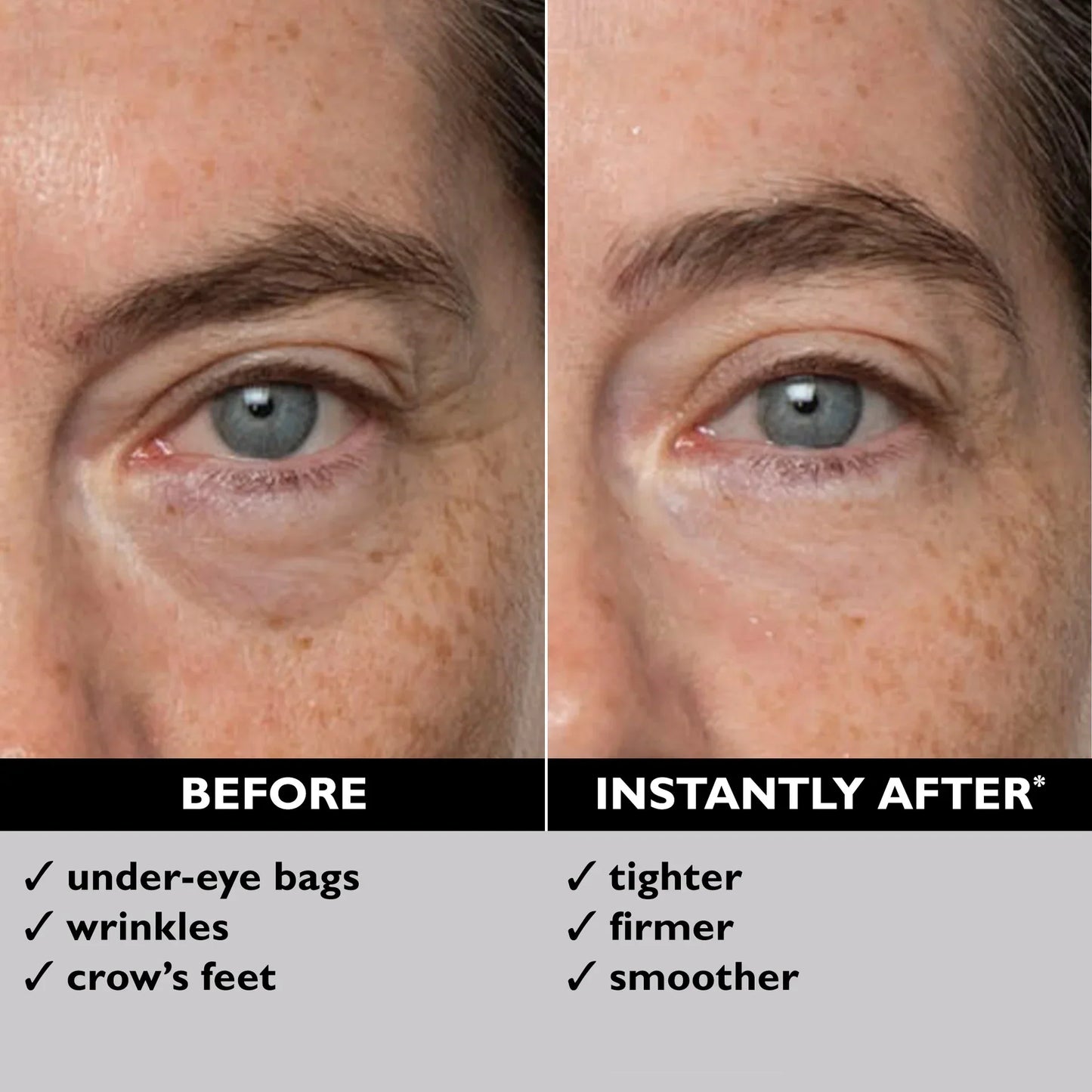Divifit™ Eye Bag Instant Eraser