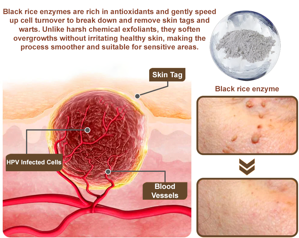 Divifit® Black Rice Skin Repair Essence Cream ⚕️ FDA Certified (Eliminates warts and skin tags, relieves psoriasis, improves keratin build-up and follicular keratinization, fades pigmentation, sun spots & age spots)