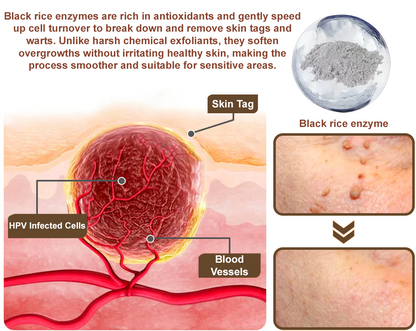Divifit® Black Rice Skin Repair Essence Cream ⚕️ FDA Certified (Eliminates warts and skin tags, relieves psoriasis, improves keratin build-up and follicular keratinization, fades pigmentation, sun spots & age spots)