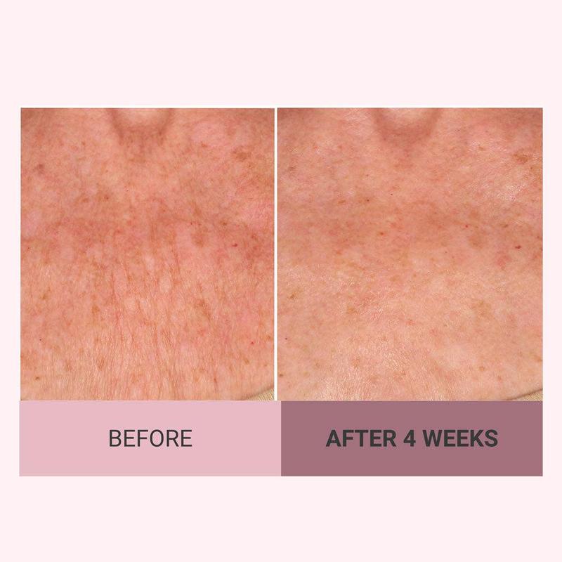 💆‍♀️ Experience Ultimate Luxury - 50% OFF - ✨ Champayne Beawte Lift Firming Body Crème - For Firmer, Smoother, Radiant Skin! 🌟（Buy 3 & Free Shipping）