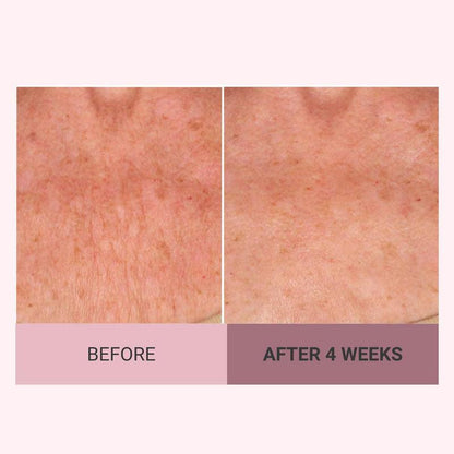 💆‍♀️ Experience Ultimate Luxury - 50% OFF - ✨ Champayne Beawte Lift Firming Body Crème - For Firmer, Smoother, Radiant Skin! 🌟（Buy 3 & Free Shipping）