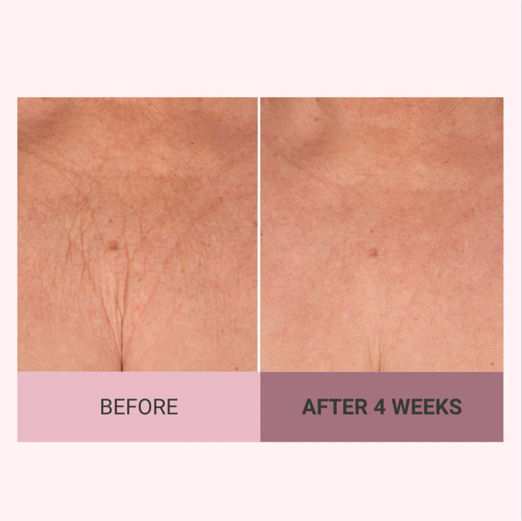 💆‍♀️ Experience Ultimate Luxury - 50% OFF - ✨ Champayne Beawte Lift Firming Body Crème - For Firmer, Smoother, Radiant Skin! 🌟（Buy 3 & Free Shipping）