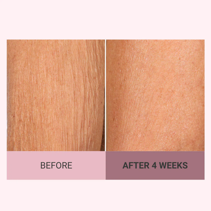 💆‍♀️ Experience Ultimate Luxury - 50% OFF - ✨ Champayne Beawte Lift Firming Body Crème - For Firmer, Smoother, Radiant Skin! 🌟（Buy 3 & Free Shipping）
