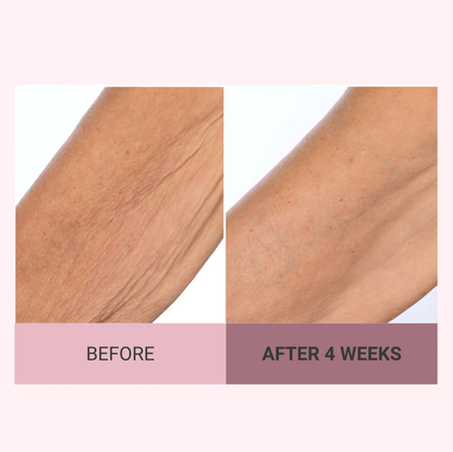 💆‍♀️ Experience Ultimate Luxury - 50% OFF - ✨ Champayne Beawte Lift Firming Body Crème - For Firmer, Smoother, Radiant Skin! 🌟（Buy 3 & Free Shipping）