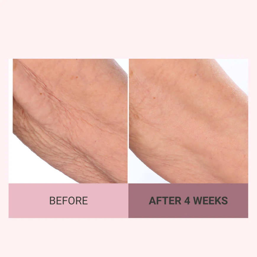 💆‍♀️ Experience Ultimate Luxury - 50% OFF - ✨ Champayne Beawte Lift Firming Body Crème - For Firmer, Smoother, Radiant Skin! 🌟（Buy 3 & Free Shipping）